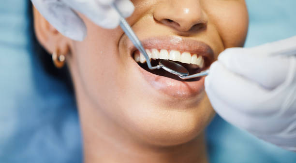 Best Emergency Dentist for Lost Fillings or Crowns in Sonora, CA
