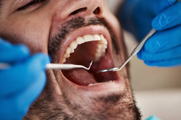 Best Broken or Cracked Tooth Emergency Dentist in Sonora, CA